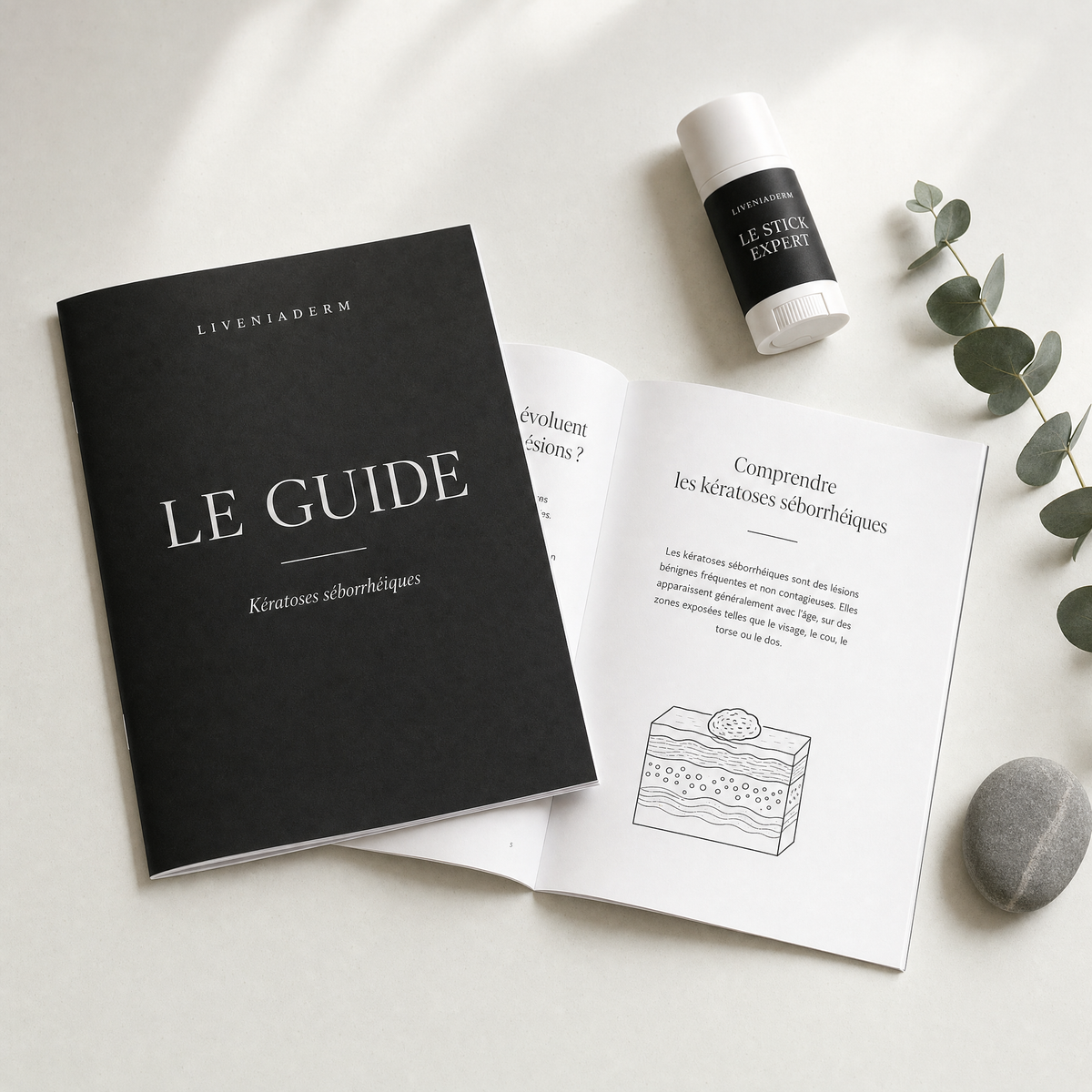 Der Liveniaderm-Leitfaden — E-Book zu seborrhoischen Keratosen